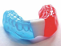 Custom Made Mouthguards in Victoria BC