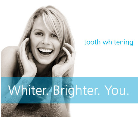Woman after teeth whitening in Victoria BC