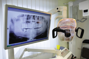 Photo of a Digital X-Ray Machine
